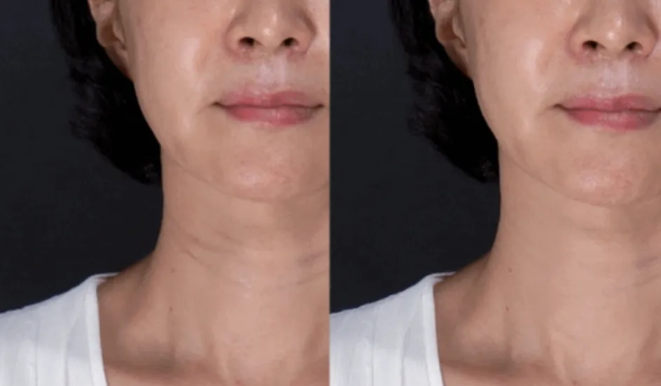 JuzBeauty-JuzBeautyMalaysia-JuzPretty-Authentic-Kbeauty-Malaysia-Skin-Care-Cosmetics-Jbeauty-Health-Care-korean-streetwear-DrMelaxin Necklinephalt Neck Cream 紧致提拉颈霜24