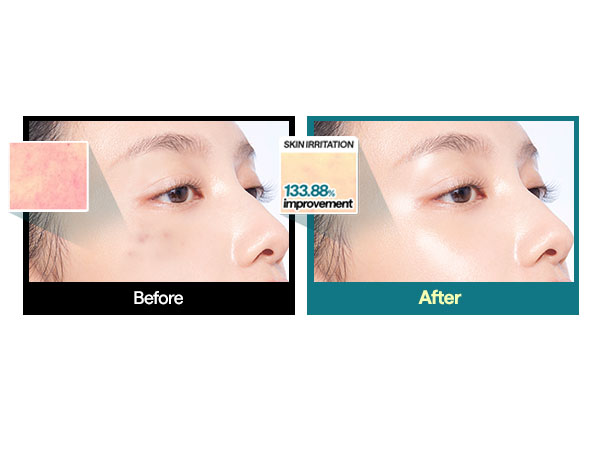 JuzBeauty-JuzBeautyMalaysia-JuzPretty-Authentic-Kbeauty-Malaysia-Skin-Care-Cosmetics-Jbeauty-Health-Care-korean-streetwear-MEDIHEAL Essential Mask Sheet 多效面膜57