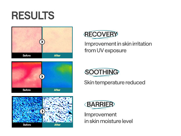 JuzBeauty-JuzBeautyMalaysia-JuzPretty-Authentic-Kbeauty-Malaysia-Skin-Care-Cosmetics-Jbeauty-Health-Care-korean-streetwear-MEDIHEAL Essential Mask Sheet 多效面膜56