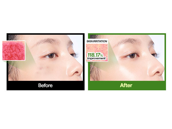 JuzBeauty-JuzBeautyMalaysia-JuzPretty-Authentic-Kbeauty-Malaysia-Skin-Care-Cosmetics-Jbeauty-Health-Care-korean-streetwear-MEDIHEAL Essential Mask Sheet 多效面膜41