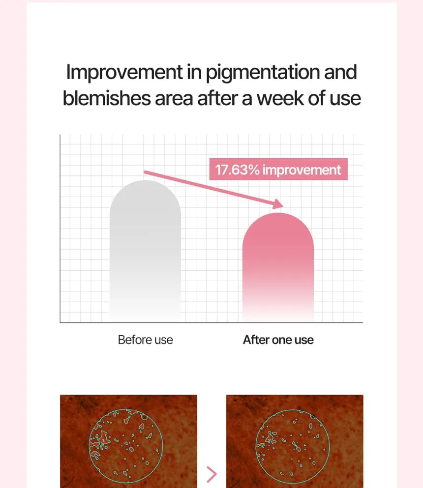 JuzBeauty_JuzBeautyMalaysia_JuzPretty_Authentic_Kbeauty_Malaysia_Skin_Care_Cosmetics_K-beauty_Health_Care_korean_streetwear_PRETTYSKIN PDRN TX1 Perfect Fit Cream TX1 粉PDRN面霜26