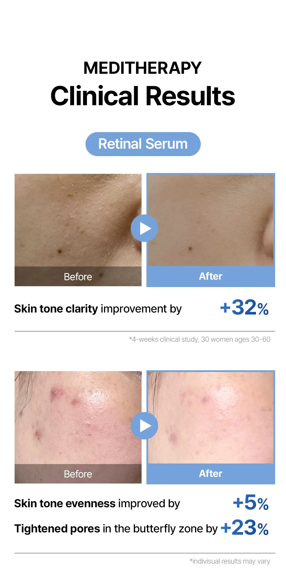 JuzBeauty_JuzBeautyMalaysia_JuzPretty_Authentic_Kbeauty_Malaysia_Skin_Care_Cosmetics_K-beauty_Health_Care_korean_streetwear_MEDITHERAPY Gentle Boost Kit 皇牌三件套旅行裝21