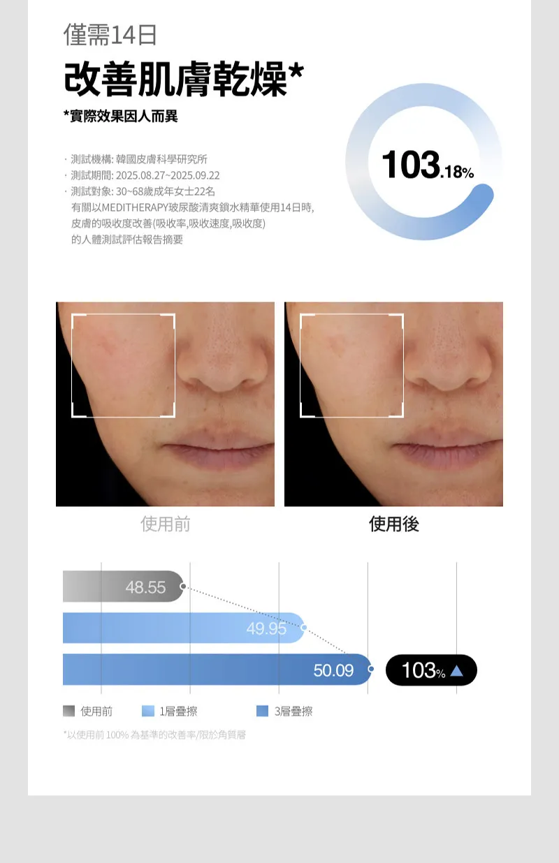 JuzBeauty_JuzBeautyMalaysia_JuzPretty_Authentic_Kbeauty_Malaysia_Skin_Care_Cosmetics_K-beauty_Health_Care_korean_streetwear_MEDITHERAPY 333 Hyaluronic Acid Skin Booster First Serum 333玻尿酸保湿精华27