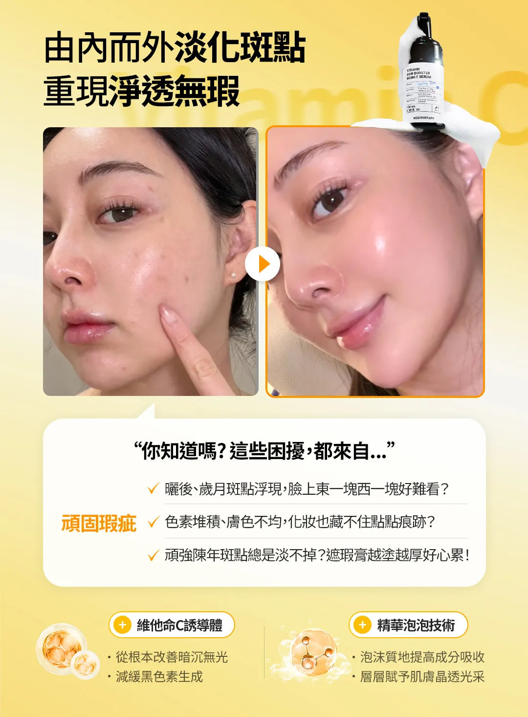 JuzBeauty_JuzBeautyMalaysia_JuzPretty_Authentic_Kbeauty_Malaysia_Skin_Care_Cosmetics_K-beauty_Health_Care_korean_streetwear_MEDITHERAPY Vitamin Skin Booster Bubble Serum 维C提亮泡泡精华18