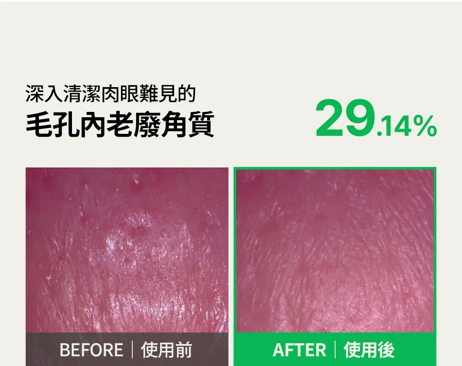 JuzBeauty_JuzBeautyMalaysia_JuzPretty_Authentic_Kbeauty_Malaysia_Skin_Care_Cosmetics_K-beauty_Health_Care_korean_streetwear_FULLY Green Tomato Cleansing Oil 绿番茄卸妆油9
