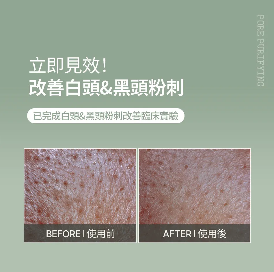 JuzBeauty_JuzBeautyMalaysia_JuzPretty_Authentic_Kbeauty_Malaysia_Skin_Care_Cosmetics_K-beauty_Health_Care_korean_streetwear_FULLY Green Tomato Clay Pack Cleanser 绿番茄洁肤泥膜17