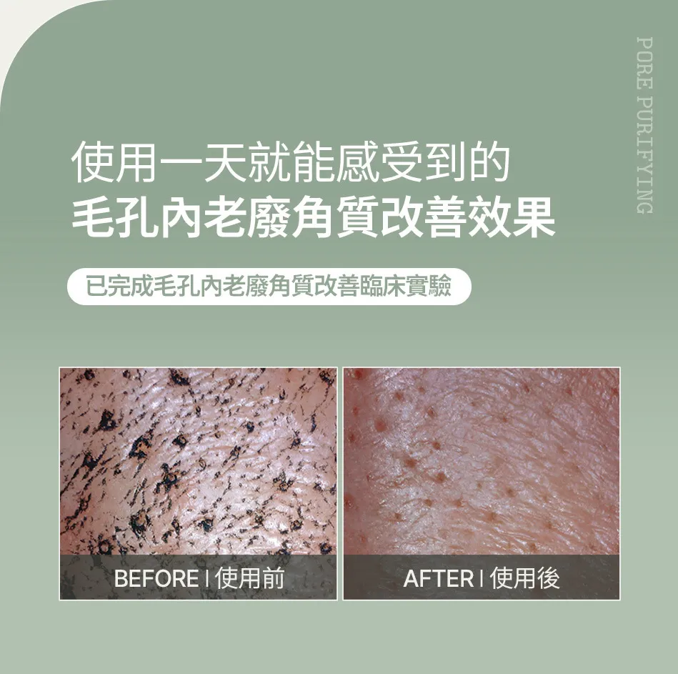 JuzBeauty_JuzBeautyMalaysia_JuzPretty_Authentic_Kbeauty_Malaysia_Skin_Care_Cosmetics_K-beauty_Health_Care_korean_streetwear_FULLY Green Tomato Clay Pack Cleanser 绿番茄洁肤泥膜11