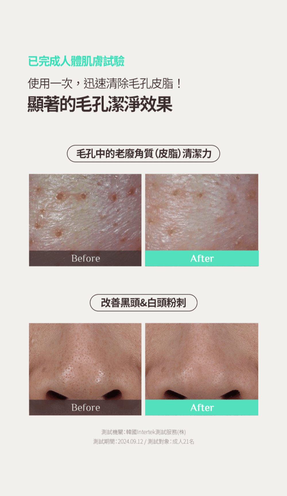 JuzBeauty_JuzBeautyMalaysia_JuzPretty_Authentic_Kbeauty_Malaysia_Skin_Care_Cosmetics_K-beauty_Health_Care_korean_streetwear_OBGE Pore Zero Moose Clay Pack 毛孔净化泥膜3