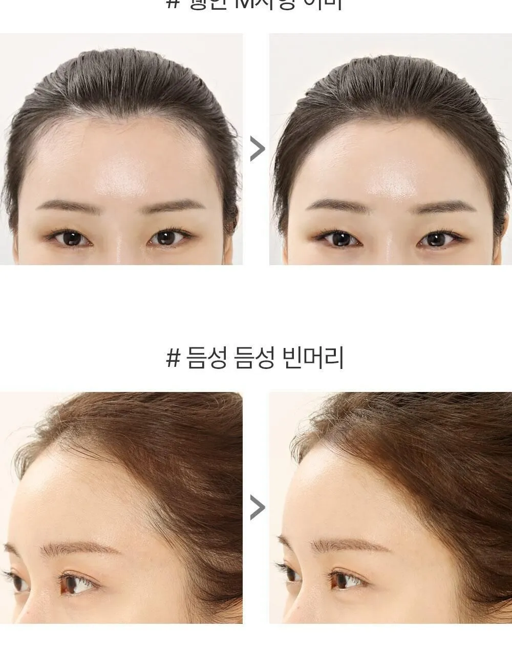 JuzBeauty_JuzBeautyMalaysia_JuzPretty_Authentic_Kbeauty_Malaysia_Skin_Care_Cosmetics_K-beauty_Health_Care_korean_streetwear_SO NATURAL Hair Line Cover Cushion 发际线遮瑕粉1