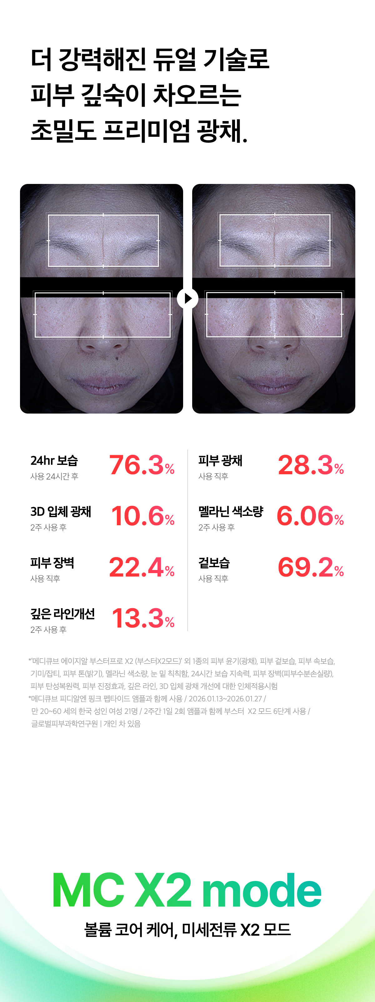 JuzBeauty_JuzBeautyMalaysia_JuzPretty_Authentic_Kbeauty_Malaysia_Skin_Care_Cosmetics_K-beauty_Health_Care_korean_streetwear_MEDICUBE AGE-R Booster Pro X2 面部护理仪X217