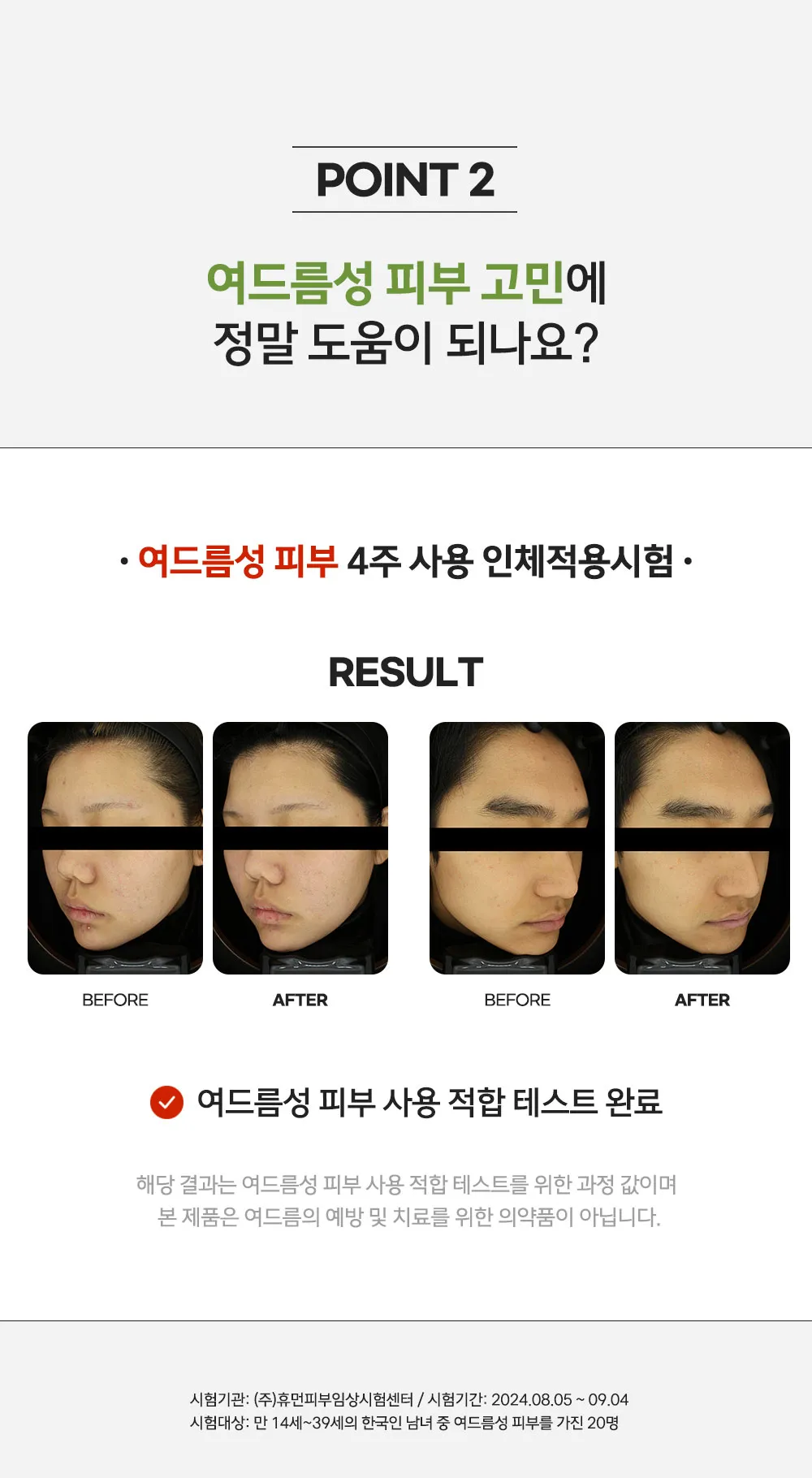 JuzBeauty_JuzBeautyMalaysia_JuzPretty_Authentic_Kbeauty_Malaysia_Skin_Care_Cosmetics_K-beauty_Health_Care_korean_streetwear_NEERG Acnic Ampoule 痘肌修护安瓶精华8