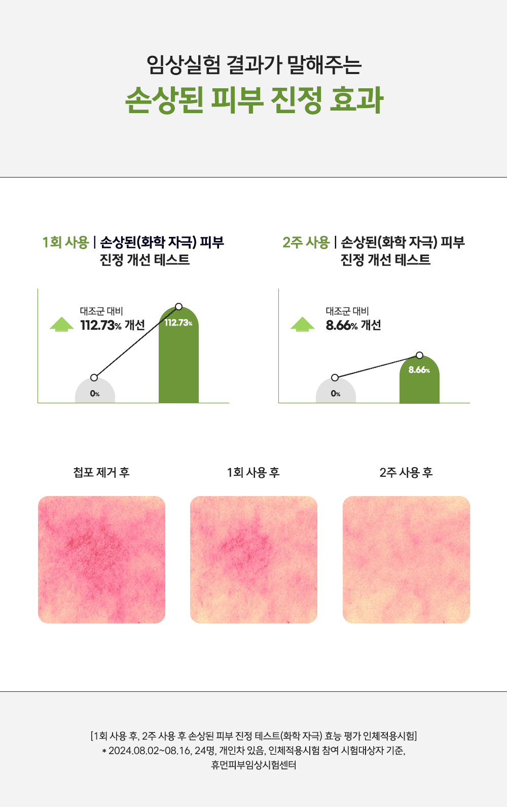 JuzBeauty_JuzBeautyMalaysia_JuzPretty_Authentic_Kbeauty_Malaysia_Skin_Care_Cosmetics_K-beauty_Health_Care_korean_streetwear_NEERG Acnic Ampoule 痘肌修护安瓶精华15