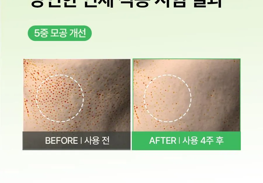 JuzBeauty_JuzBeautyMalaysia_JuzPretty_Authentic_Kbeauty_Malaysia_Skin_Care_Cosmetics_K-beauty_Health_Care_korean_streetwear_FULLY Green Tomato Acid 20 Wash-Off Peeling Serum 绿番茄 Acid 20 焕肤精华5