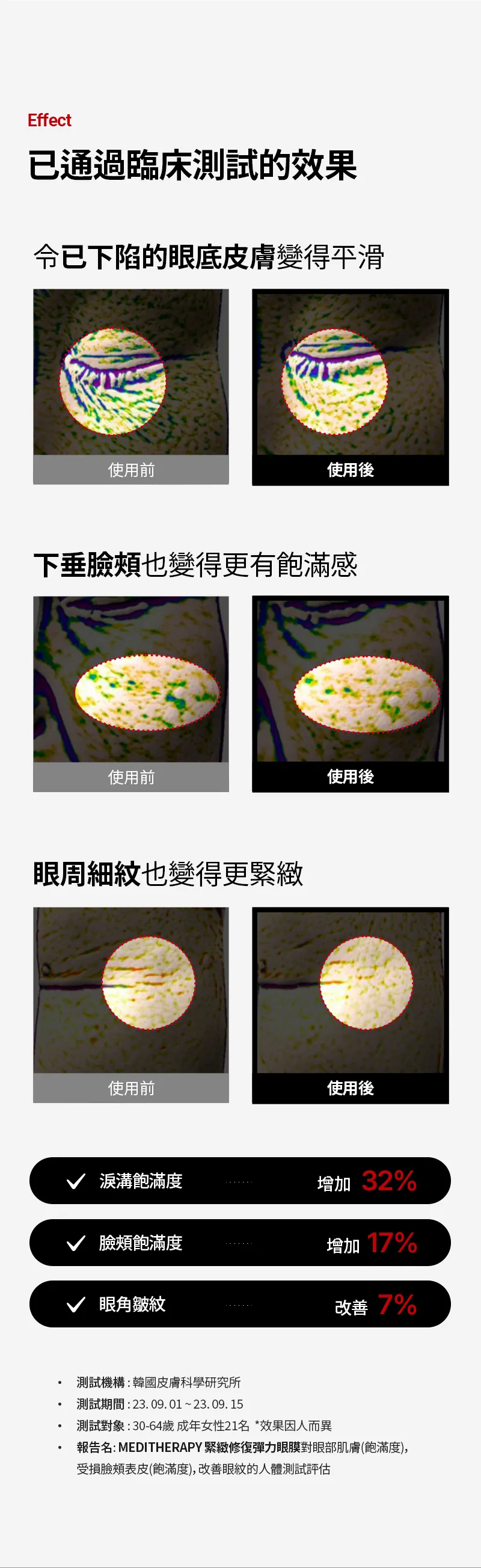 JuzBeauty_JuzBeautyMalaysia_JuzPretty_Authentic_Kbeauty_Malaysia_Skin_Care_Cosmetics_K-beauty_Health_Care_korean_streetwear_MEDITHERAPY Wrinkle-fit Tangle Eye Patch 紧致胶原蛋白眼膜22