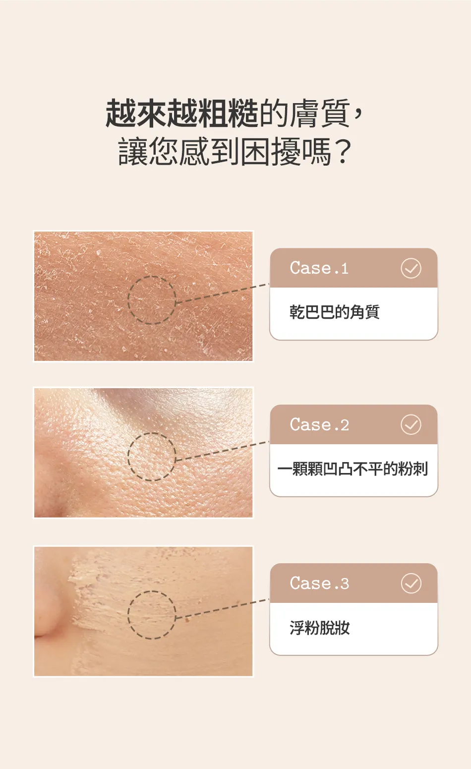 JuzBeauty_JuzBeautyMalaysia_JuzPretty_Authentic_Kbeauty_Malaysia_Skin_Care_Cosmetics_K-beauty_Health_Care_korean_streetwear_FULLY Adlay Niacin Grain Mask 薏仁烟酰胺谷物泥膜 2