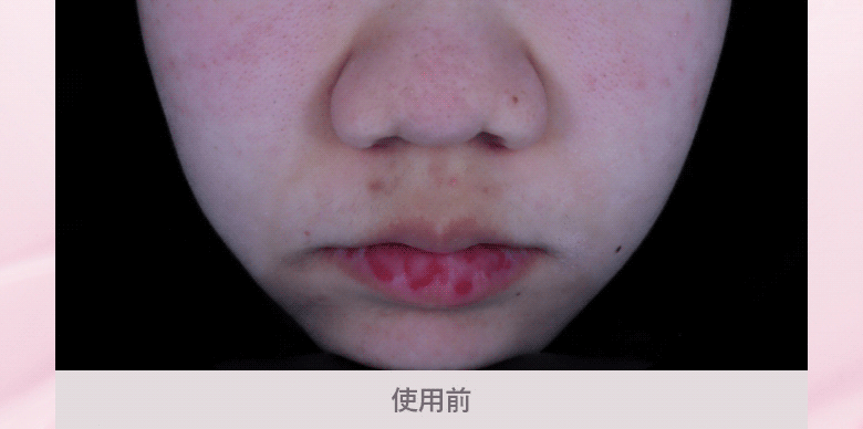 JuzBeauty_JuzBeautyMalaysia_JuzPretty_Authentic_Kbeauty_Malaysia_Skin_Care_Cosmetics_K-beauty_Health_Care_korean_streetwear_MEDITHERAPY Porethera Real Bifida Pink Blur Cream 粉红柔肤霜8