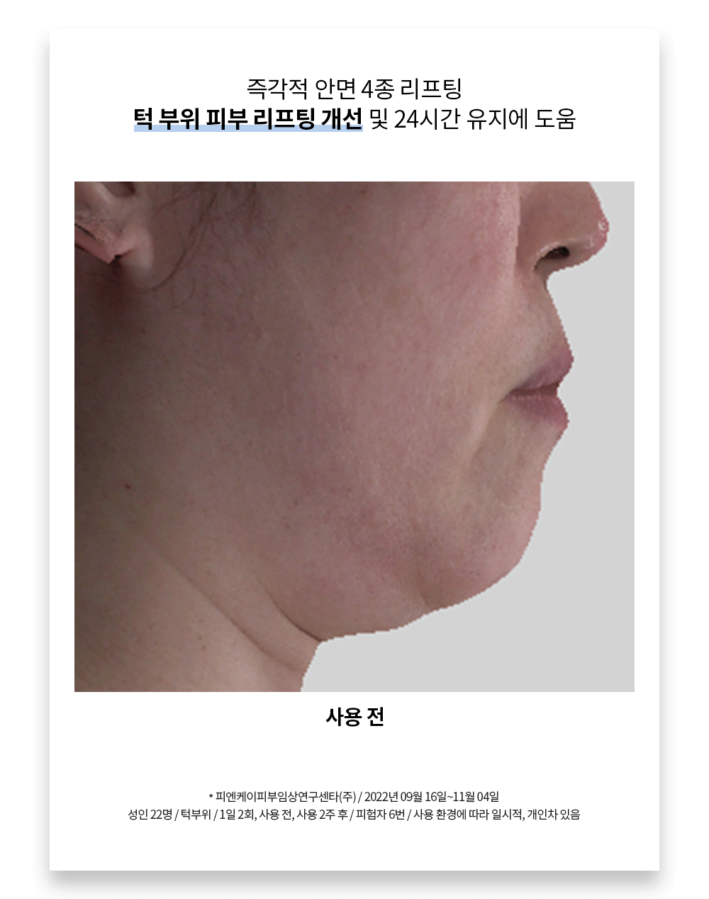 JuzBeauty_JuzBeautyMalaysia_JuzPretty_Authentic_Kbeauty_Malaysia_Skin_Care_Cosmetics_K-beauty_Health_Care_korean_streetwear_LAVIEN Medinic Line Miracle Stem Exo Sphingosome Cream 奇迹干细胞外泌体神经鞘氨醇修护面霜12