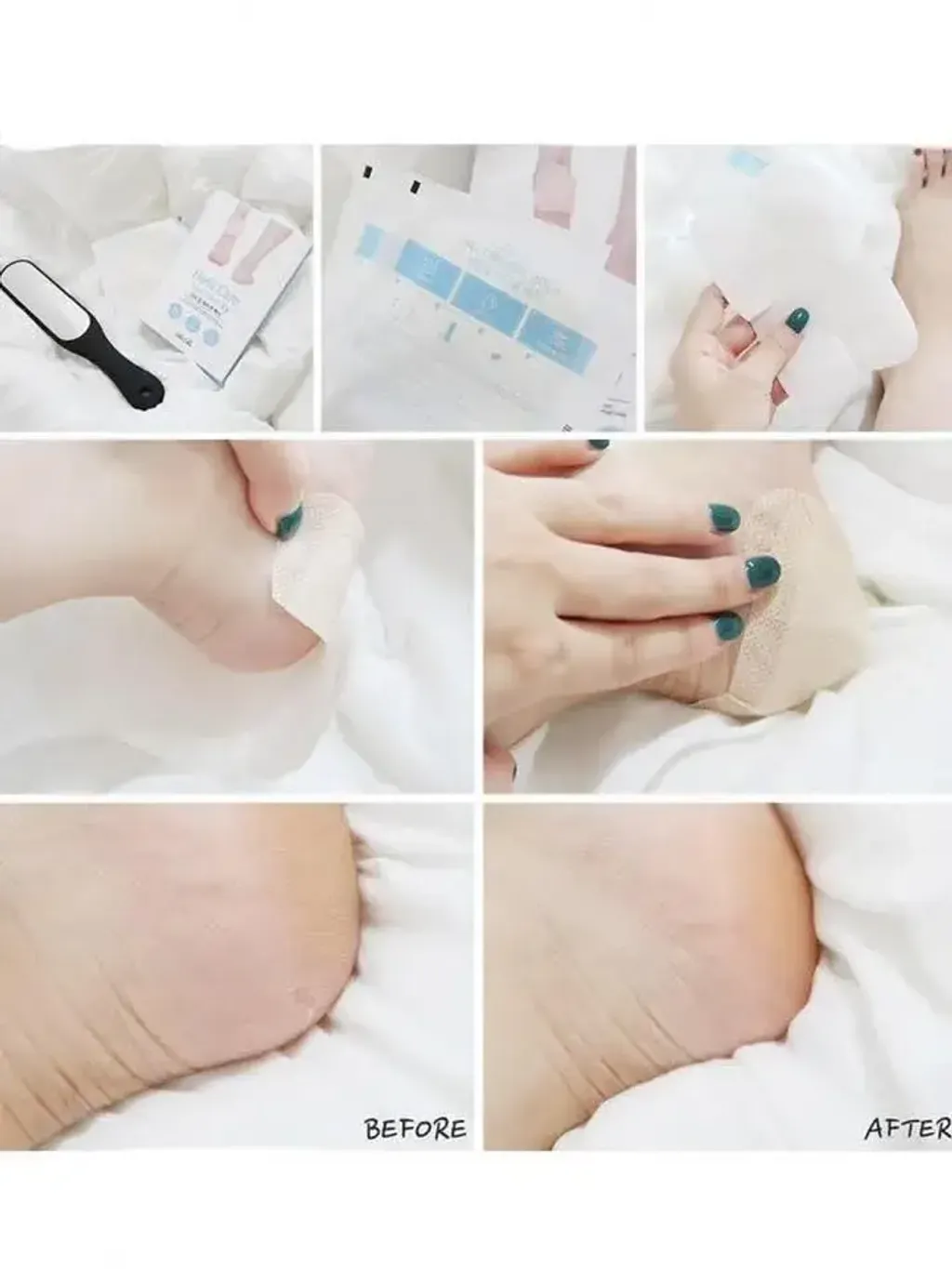 JuzBeauty_JuzBeautyMalaysia_JuzPretty_Authentic_Kbeauty_Malaysia_Skin_Care_Cosmetics_K-beauty_Health_Care_korean_streetwear_RiRe Heel Care Foot Patch 足跟龟裂修复贴1