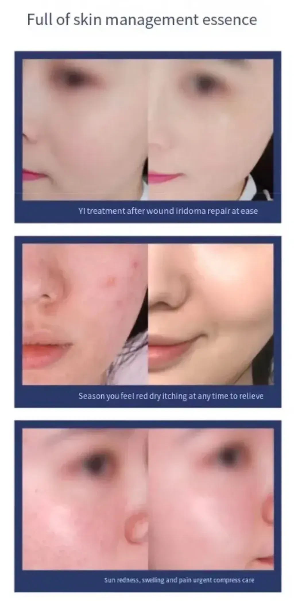 JuzBeauty_JuzBeautyMalaysia_JuzPretty_Authentic_Kbeauty_Malaysia_Skin_Care_Cosmetics_K-beauty_Health_Care_korean_streetwear_HEALOINE Moisture Ample Mask 水光面膜23