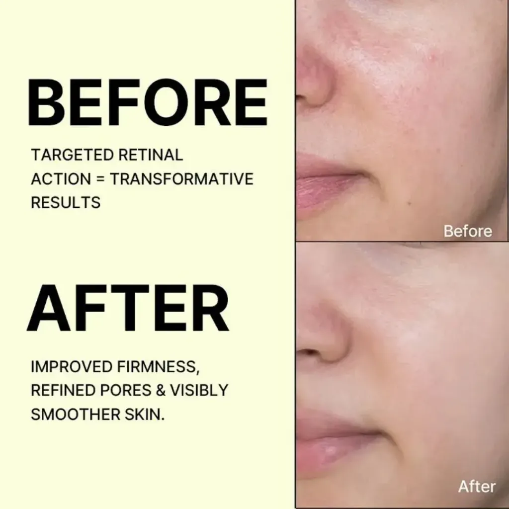 JuzBeauty_JuzBeautyMalaysia_JuzPretty_Authentic_Kbeauty_Malaysia_Skin_Care_Cosmetics_K-beauty_Health_Care_korean_streetwear_CELIMAX The Vita-A Retinal Shot Tightening Booster 维A视黄醛精华5