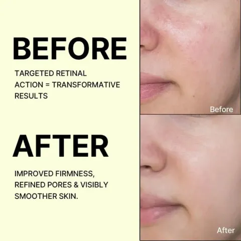 JuzBeauty_JuzBeautyMalaysia_JuzPretty_Authentic_Kbeauty_Malaysia_Skin_Care_Cosmetics_K-beauty_Health_Care_korean_streetwear_CELIMAX The Vita-A Retinal Shot Tightening Booster 维A视黄醛精华5