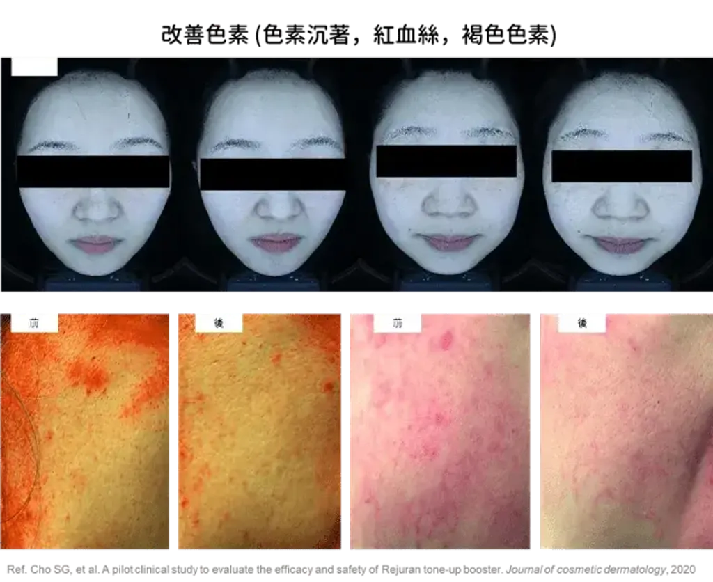 JuzBeauty_JuzBeautyMalaysia_JuzPretty_Authentic_Kbeauty_Malaysia_Skin_Care_Cosmetics_K-beauty_Health_Care_korean_streetwear_REJURAN Synergy Skin Booster 焕亮修护水光精华 REJURAN Synergy Tone-Up Booster 白瓷水光精华9