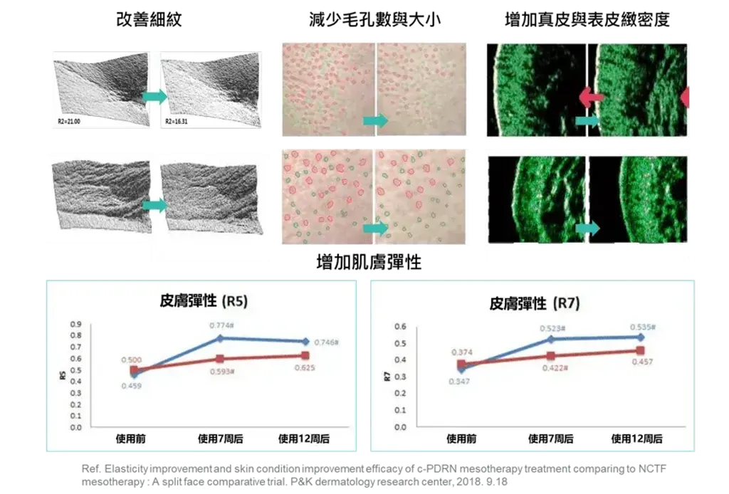 JuzBeauty_JuzBeautyMalaysia_JuzPretty_Authentic_Kbeauty_Malaysia_Skin_Care_Cosmetics_K-beauty_Health_Care_korean_streetwear_REJURAN Synergy Skin Booster 焕亮修护水光精华 REJURAN Synergy Tone-Up Booster 白瓷水光精华8
