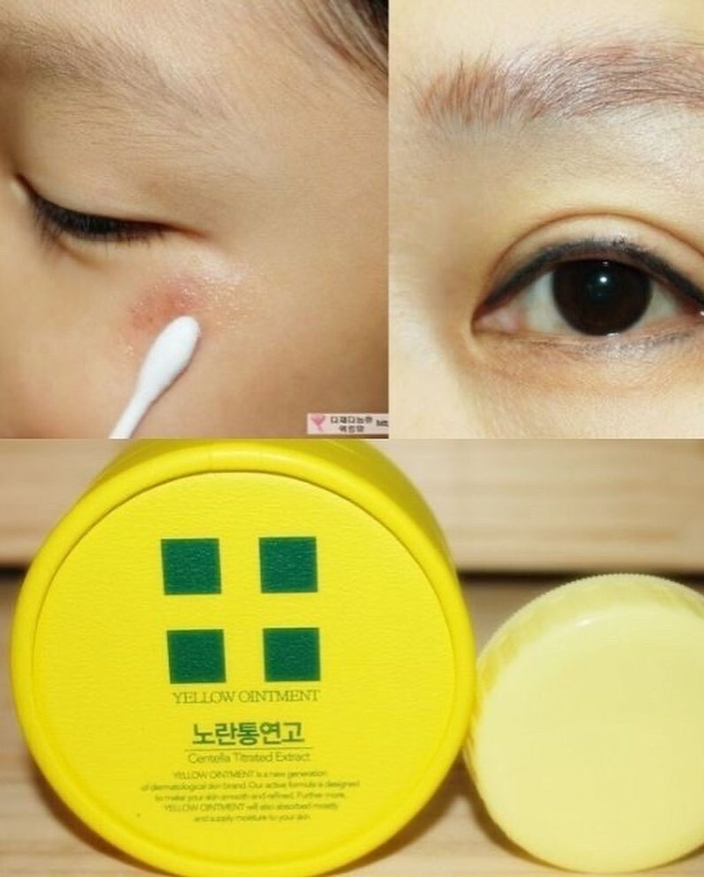 JuzBeauty_JuzBeautyMalaysia_JuzPretty_Authentic_Kbeauty_Malaysia_Jbeauty_Australia_Health_Care_Yellow_Ointment_Centella_Titrated_Extract_ (3).jpg