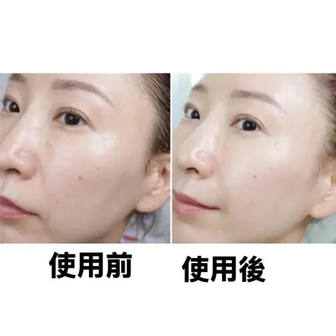 _Skin_Care_Cosmetics_K-beauty_Health_Care_korean_streetwear_SWANICOCO PDRN Hydrating Repair Ampoule PDRN 水感再生精华安瓶5
