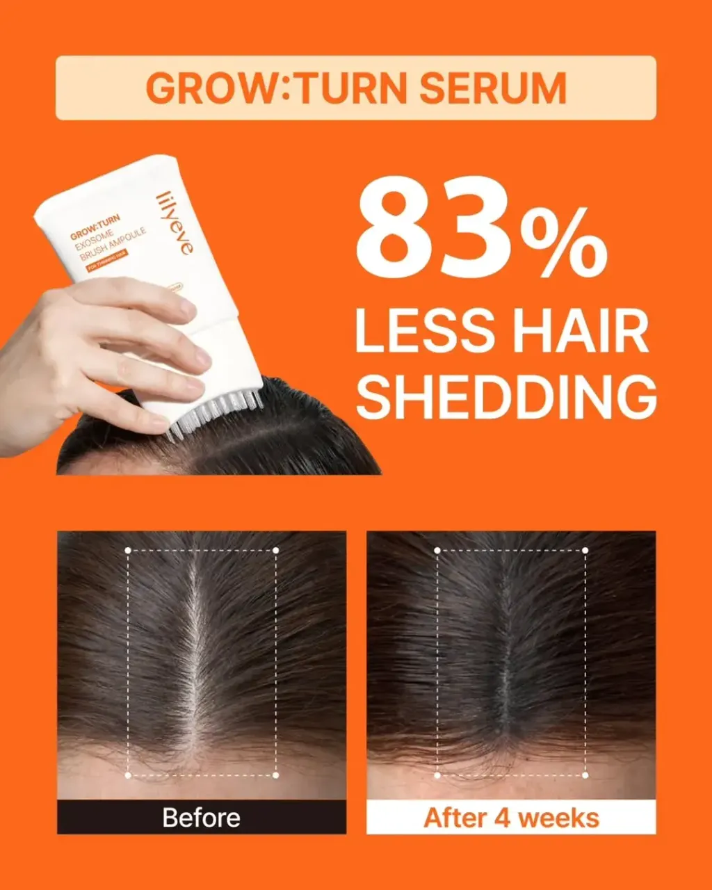 JuzBeauty_JuzBeautyMalaysia_JuzPretty_Authentic_Kbeauty_Malaysia_Skin_Care_Cosmetics_K-beauty_Health_Care_korean_streetwear_lilyeve Grow:Turn Exosome Brush Ampoule 防脱发刷安瓶 22