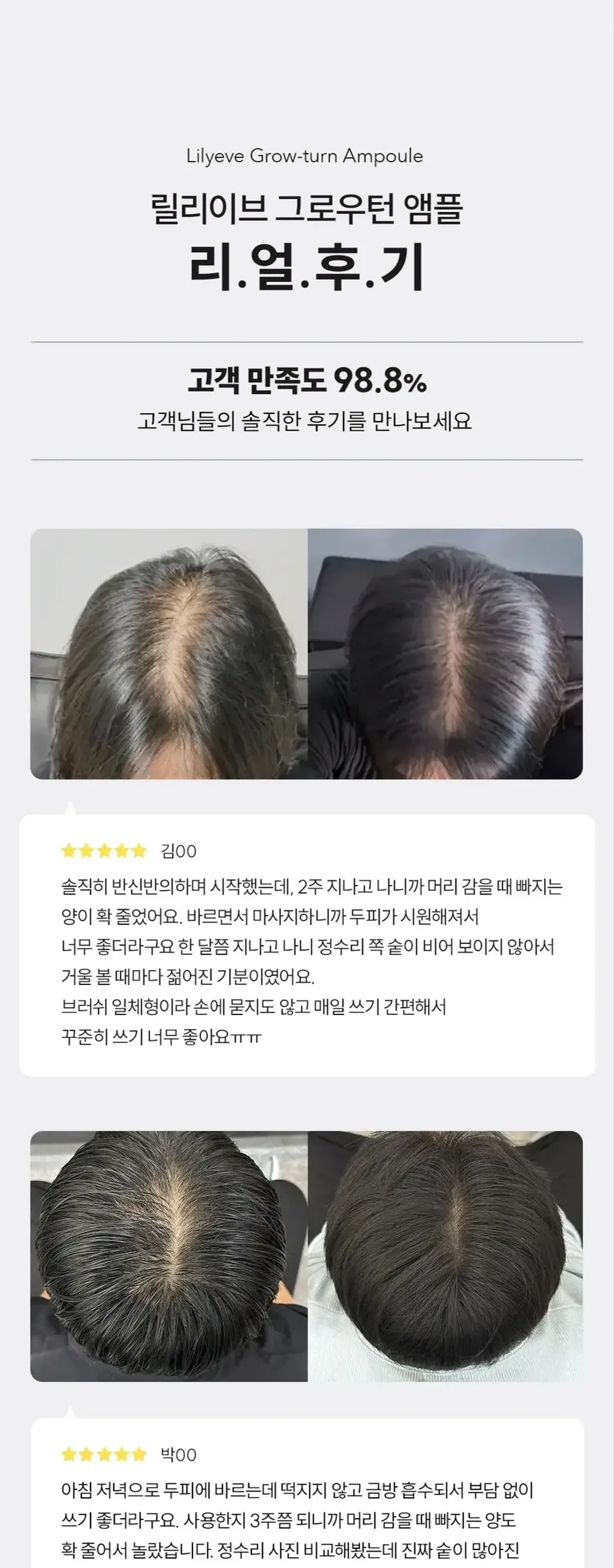 JuzBeauty_JuzBeautyMalaysia_JuzPretty_Authentic_Kbeauty_Malaysia_Skin_Care_Cosmetics_K-beauty_Health_Care_korean_streetwear_lilyeve Grow:Turn Exosome Brush Ampoule 防脱发刷安瓶 21