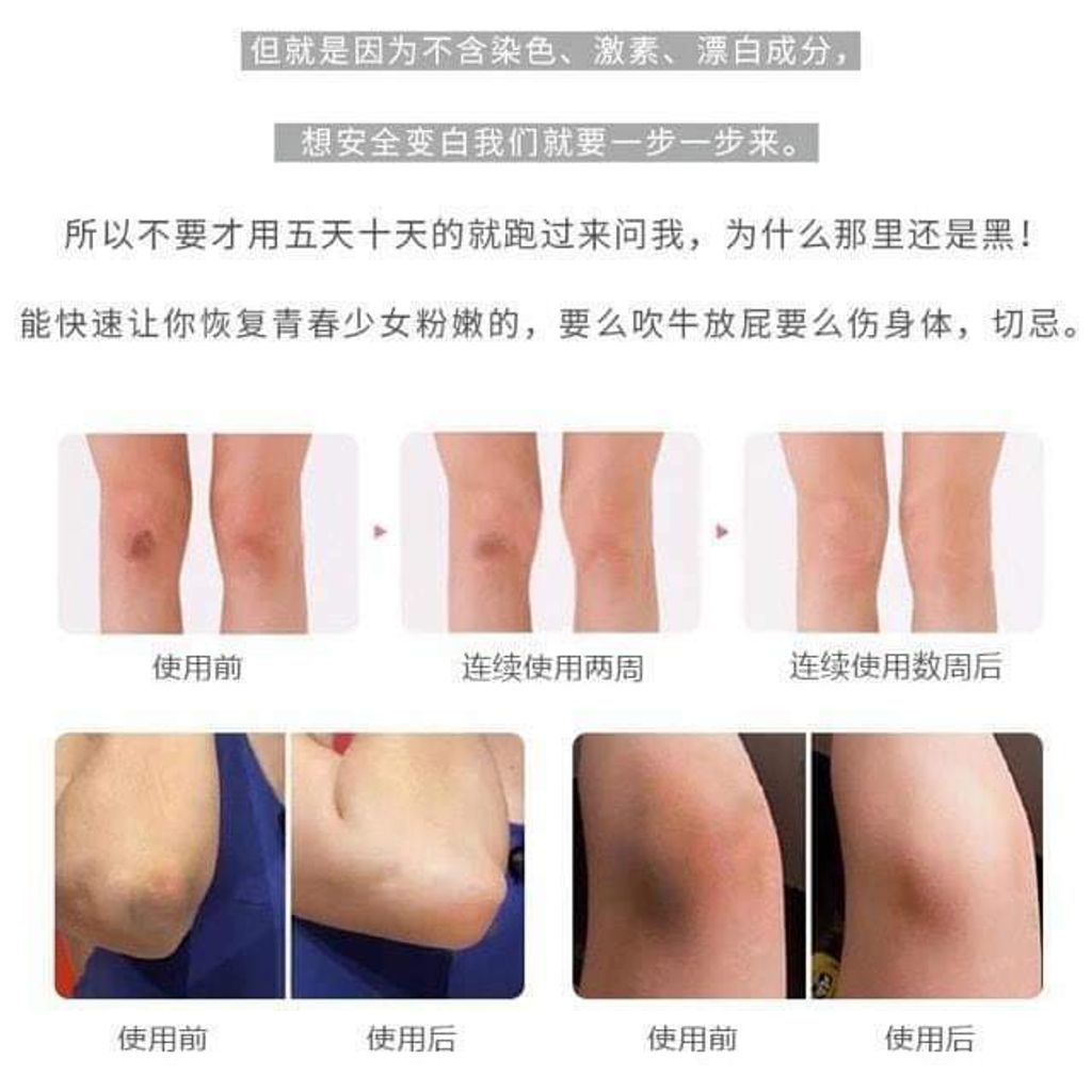 JuzBeauty_JuzBeautyMalaysia_JuzPretty_Authentic_Kbeauty_Malaysia_Skin_Care_Cosmetics_Jbeauty_Australia_Health_Care_Maputi_Organic_Fragrance_White_Cream_ (19).jpg