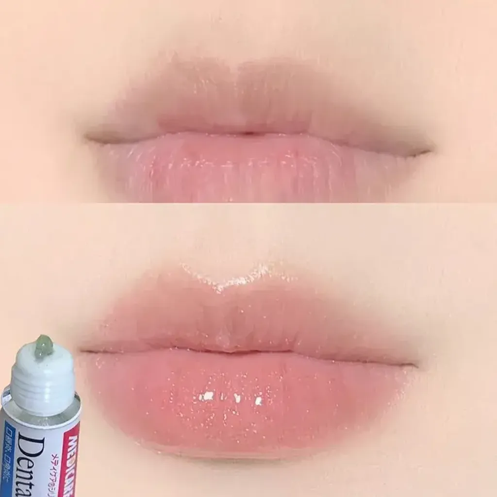 JuzBeauty_JuzBeautyMalaysia_JuzPretty_Authentic_Kbeauty_Malaysia_Skin_Care_Cosmetics_K-beauty_Health_Care_korean_streetwear_MORISHITA JINTAN MEDICARE Dental Pill Cream 森下仁丹消炎润唇膏1