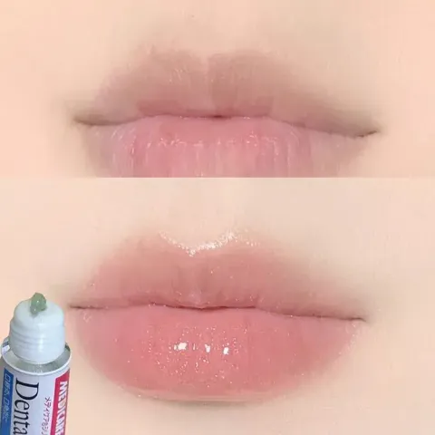 JuzBeauty_JuzBeautyMalaysia_JuzPretty_Authentic_Kbeauty_Malaysia_Skin_Care_Cosmetics_K-beauty_Health_Care_korean_streetwear_MORISHITA JINTAN MEDICARE Dental Pill Cream 森下仁丹消炎润唇膏1