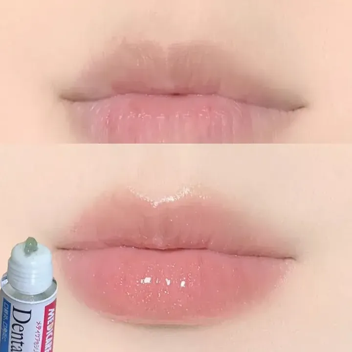 JuzBeauty_JuzBeautyMalaysia_JuzPretty_Authentic_Kbeauty_Malaysia_Skin_Care_Cosmetics_K-beauty_Health_Care_korean_streetwear_MORISHITA JINTAN MEDICARE Dental Pill Cream 森下仁丹消炎润唇膏1