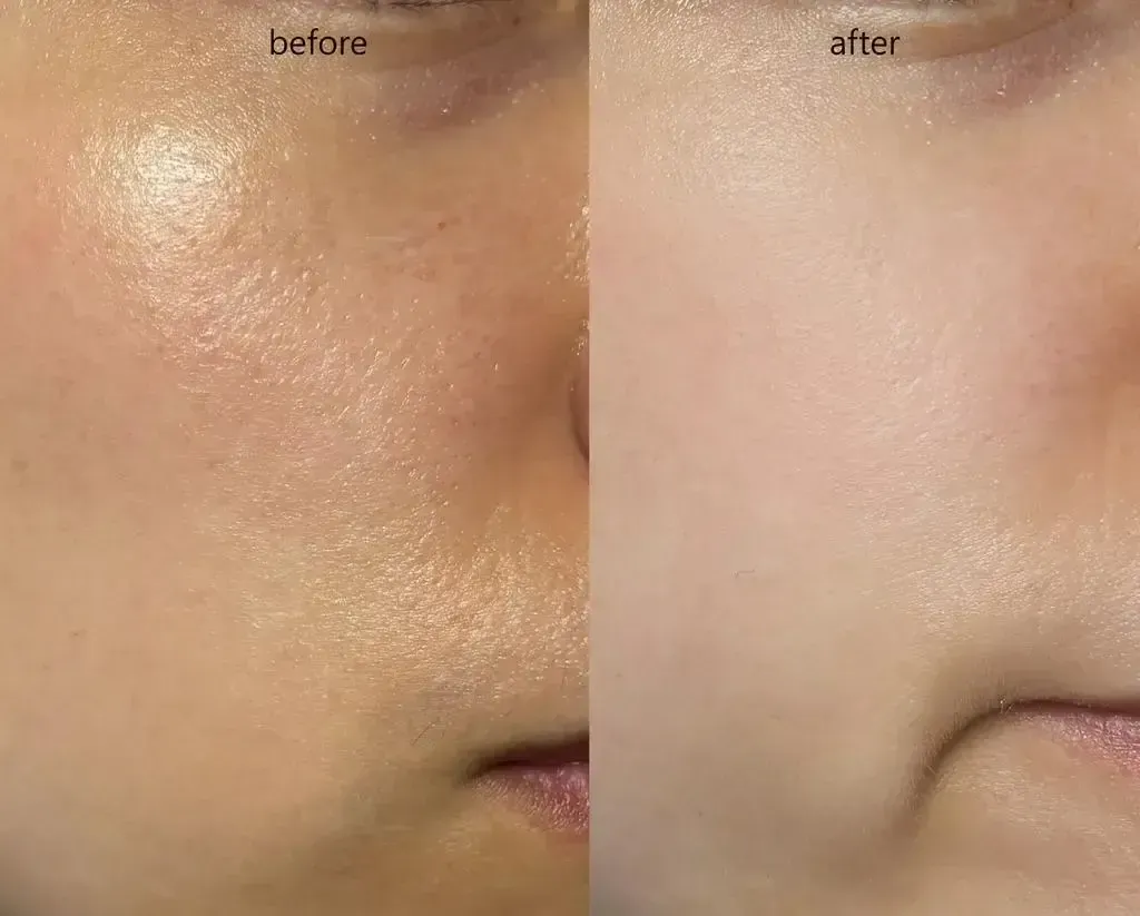 JuzBeauty_JuzBeautyMalaysia_JuzPretty_Authentic_Kbeauty_Malaysia_Skin_Care_Cosmetics_K-beauty_Health_Care_korean_streetwear_MEDITHERAPY Porethera Real Bifida Powder Serum 微毛孔益生菌粉末精华1