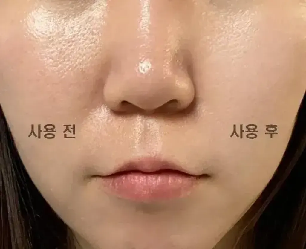 JuzBeauty_JuzBeautyMalaysia_JuzPretty_Authentic_Kbeauty_Malaysia_Skin_Care_Cosmetics_K-beauty_Health_Care_korean_streetwear_MEDITHERAPY Porethera Real Bifida Powder Serum 微毛孔益生菌粉末精华3