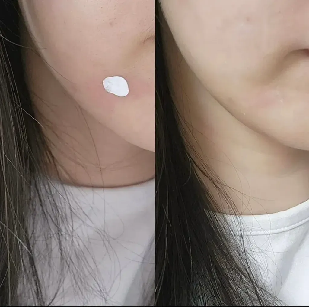 JuzBeauty_JuzBeautyMalaysia_JuzPretty_Authentic_Kbeauty_Malaysia_Skin_Care_Cosmetics_K-beauty_Health_Care_korean_streetwear_BRLAB Super Spot Remover Pro 净痘小蓝瓶精华Pro版 5