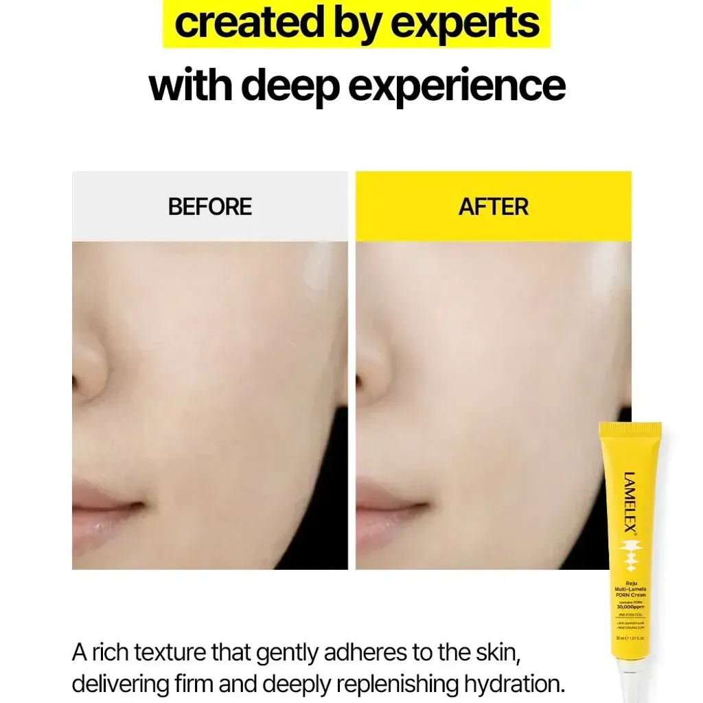 JuzBeauty_JuzBeautyMalaysia_JuzPretty_Authentic_Kbeauty_Malaysia_Skin_Care_Cosmetics_K-beauty_Health_Care_korean_streetwear_LAMELEX Reju Multi-lamella PDRN Cream PDRN焕活修护面霜2
