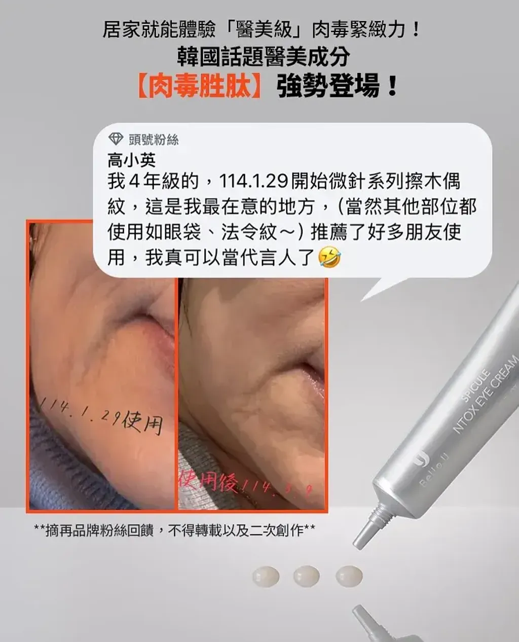 JuzBeauty_JuzBeautyMalaysia_JuzPretty_Authentic_Kbeauty_Malaysia_Skin_Care_Cosmetics_K-beauty_Health_Care_korean_streetwear_BELLO.U Spicule Ntox Eye Cream BELLOU 美丽优微针肉毒眼霜7