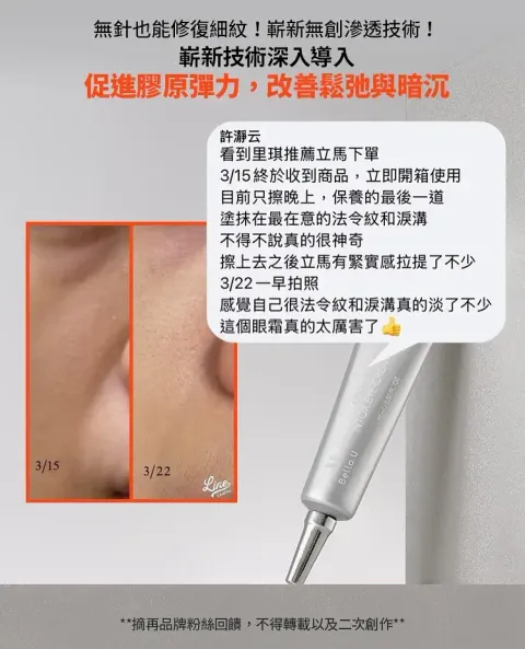 JuzBeauty_JuzBeautyMalaysia_JuzPretty_Authentic_Kbeauty_Malaysia_Skin_Care_Cosmetics_K-beauty_Health_Care_korean_streetwear_BELLO.U Spicule Ntox Eye Cream BELLOU 美丽优微针肉毒眼霜9