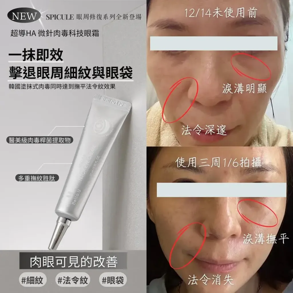 JuzBeauty_JuzBeautyMalaysia_JuzPretty_Authentic_Kbeauty_Malaysia_Skin_Care_Cosmetics_K-beauty_Health_Care_korean_streetwear_BELLO.U Spicule Ntox Eye Cream BELLOU 美丽优微针肉毒眼霜6