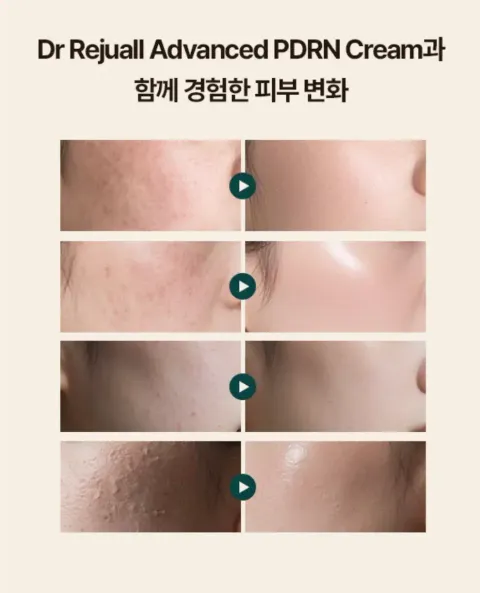 JuzBeauty_JuzBeautyMalaysia_JuzPretty_Authentic_Kbeauty_Malaysia_Skin_Care_Cosmetics_K-beauty_Health_Care_korean_streetwear_DR REJUALL Advanced PDRN Rejuvenating Cream DR REJU ALL 医美级高浓度PDRN再生修护3
