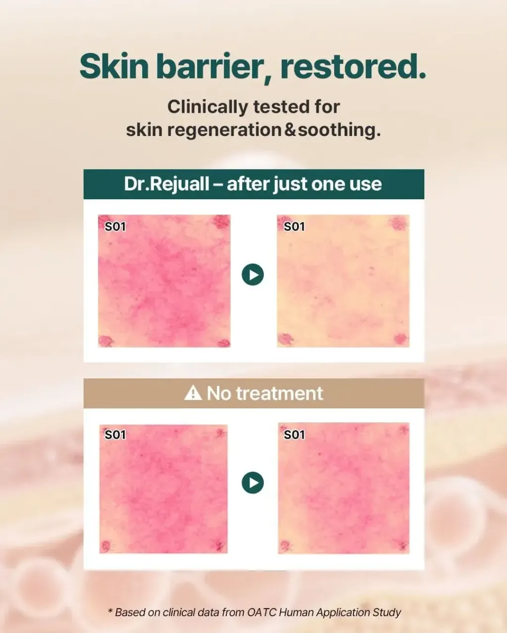 JuzBeauty_JuzBeautyMalaysia_JuzPretty_Authentic_Kbeauty_Malaysia_Skin_Care_Cosmetics_K-beauty_Health_Care_korean_streetwear_DR REJUALL Advanced PDRN Rejuvenating Cream DR REJU ALL 医美级高浓度PDRN再生修护18