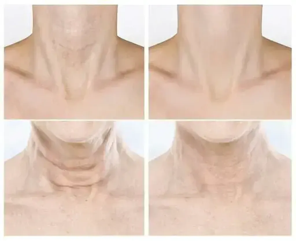 JuzBeauty_JuzBeautyMalaysia_JuzPretty_Authentic_Kbeauty_Malaysia_Skin_Care_Cosmetics_K-beauty_Health_Care_korean_streetwear_VELLA Neck Patch Prestige Wrinkle Free 5ea 深层抚纹熨斗颈膜3