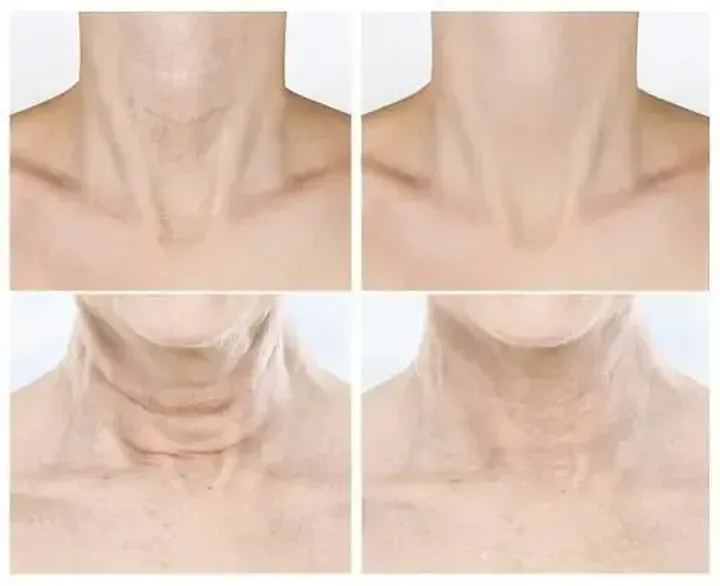 JuzBeauty_JuzBeautyMalaysia_JuzPretty_Authentic_Kbeauty_Malaysia_Skin_Care_Cosmetics_K-beauty_Health_Care_korean_streetwear_VELLA Neck Patch Prestige Wrinkle Free 5ea 深层抚纹熨斗颈膜3