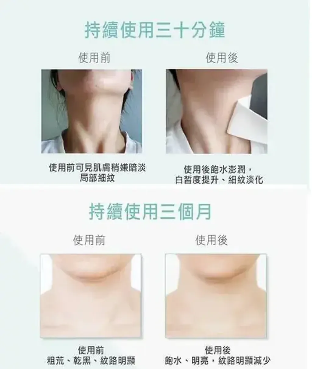 JuzBeauty_JuzBeautyMalaysia_JuzPretty_Authentic_Kbeauty_Malaysia_Skin_Care_Cosmetics_K-beauty_Health_Care_korean_streetwear_VELLA Neck Patch Prestige Wrinkle Free 5ea 深层抚纹熨斗颈膜4