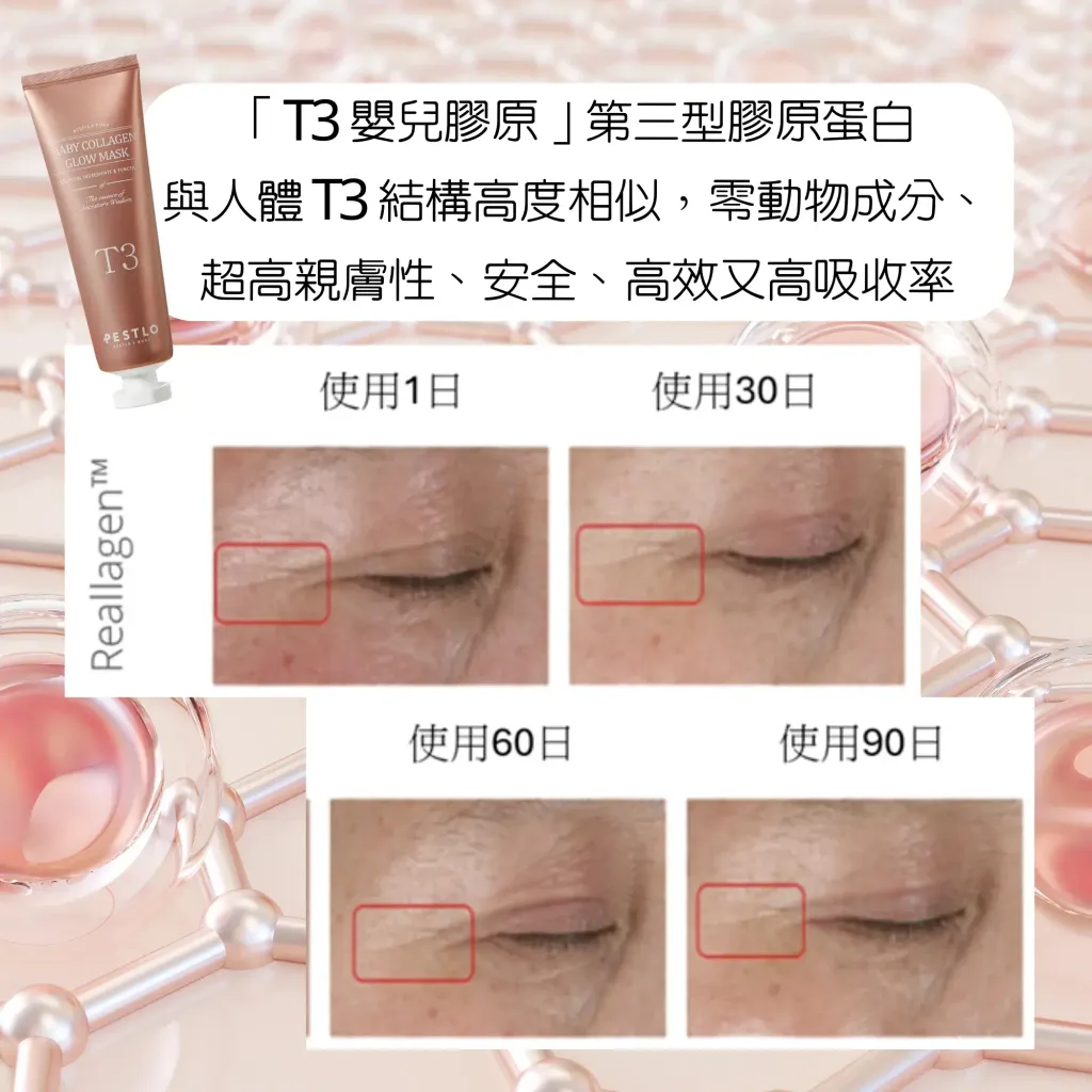 JuzBeauty_JuzBeautyMalaysia_JuzPretty_Authentic_Kbeauty_Malaysia_Skin_Care_Cosmetics_K-beauty_Health_Care_korean_streetwear_HANMI PROCALM Red X Cream 美白抗皱面霜10