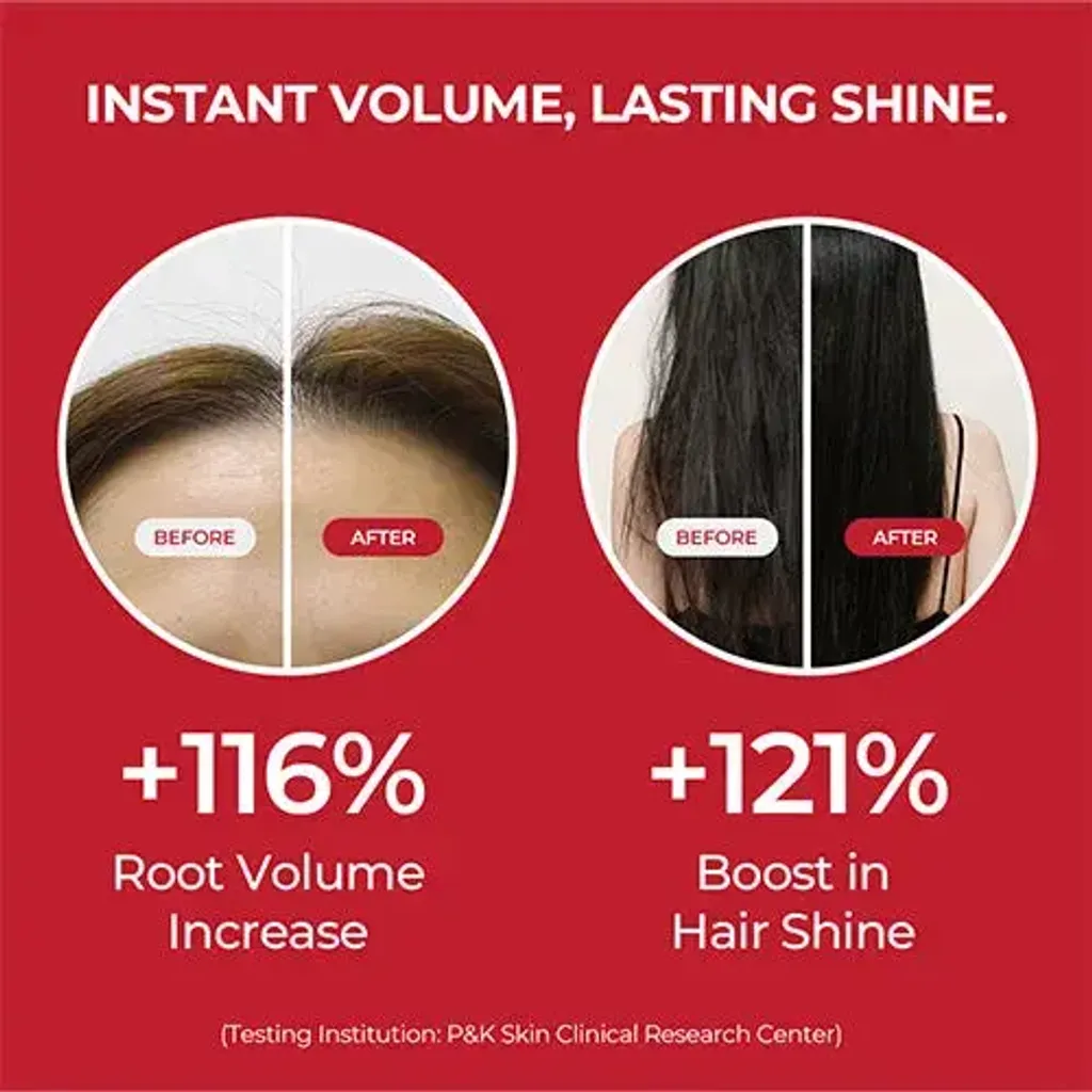 JuzBeauty_JuzBeautyMalaysia_JuzPretty_Authentic_Kbeauty_Malaysia_Skin_Care_Cosmetics_K-beauty_Health_Care_korean_streetwear_MOEV Annurcatin Shampoo 安诺卡汀苹果多酚防脱洗发水10