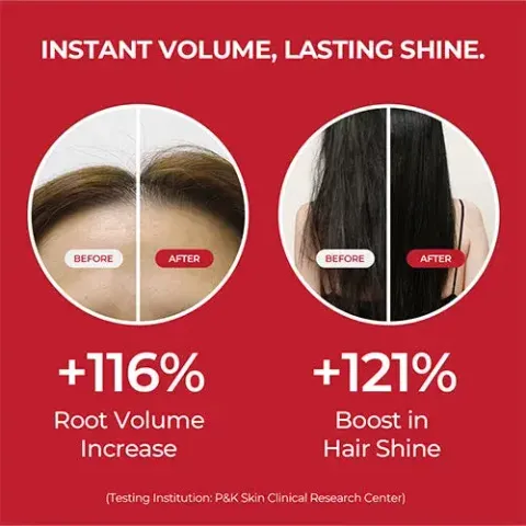 JuzBeauty_JuzBeautyMalaysia_JuzPretty_Authentic_Kbeauty_Malaysia_Skin_Care_Cosmetics_K-beauty_Health_Care_korean_streetwear_MOEV Annurcatin Shampoo 安诺卡汀苹果多酚防脱洗发水10